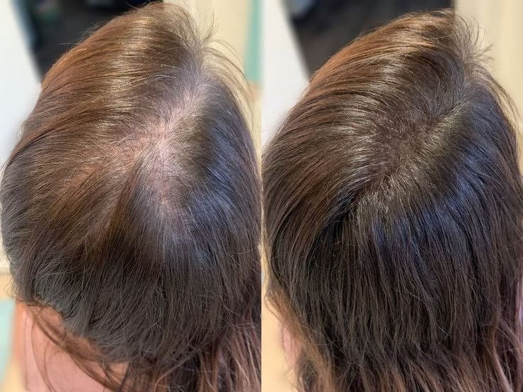 Hair Growth Serum 12*6 ml
